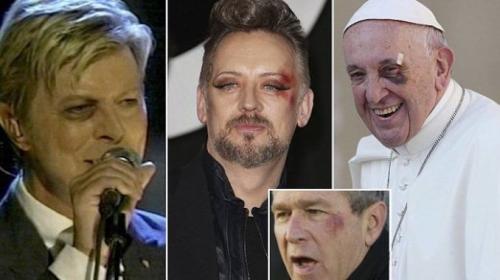 black-eye-celebrities-678x381.jpg.optimal