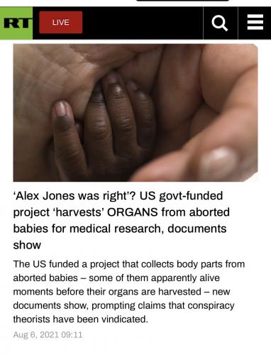 government funded aborted baby parts