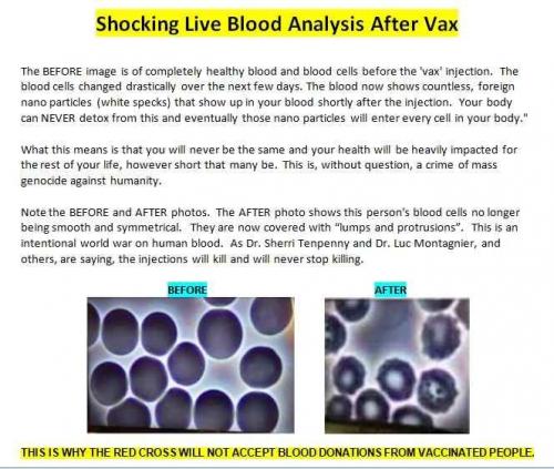 VACCINE ANALYSIS