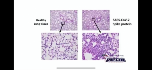 10AA4939-CE9B-4BF1-9A04-999A5BED470C