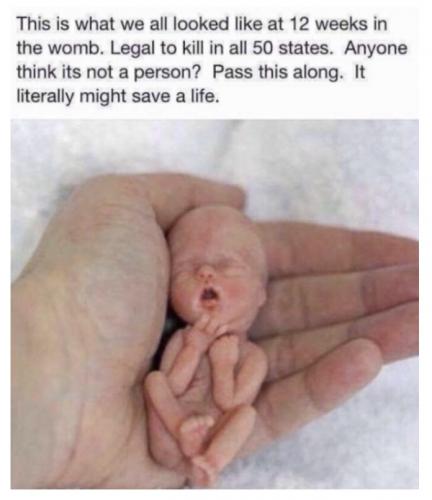 What We All Look Like - 12 Weeks In The Womb