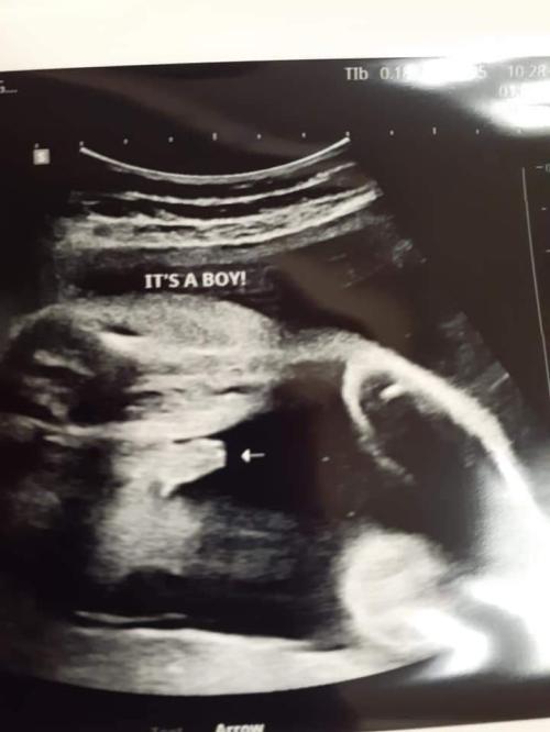 It's a boy