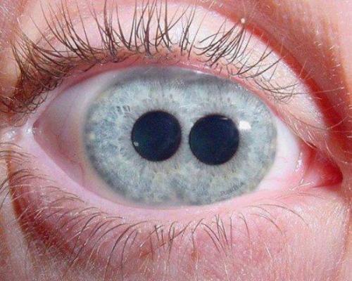 2 eyes - Copy