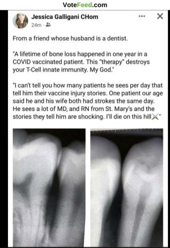 form a friend whose husband is a dentist covid vaccinated patient