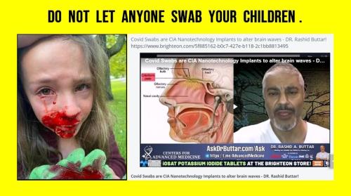 NO SWAB