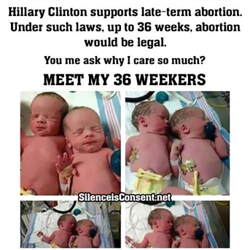 abortion 36 weekers