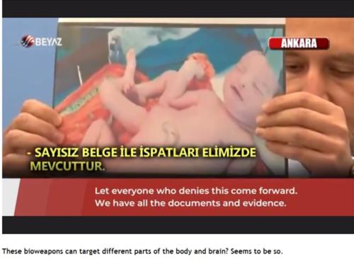 VaccineBirthDefects3a