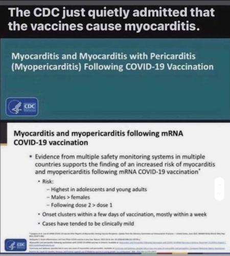 myocarditist 13