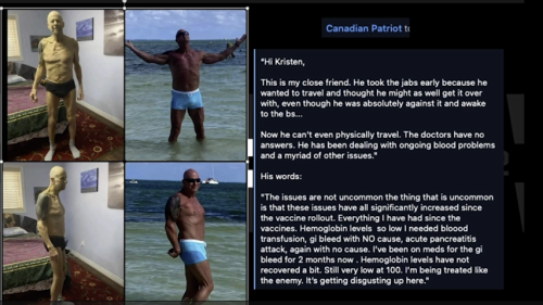 before jab vs after jab