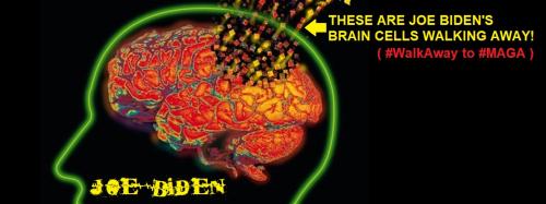 brain cells