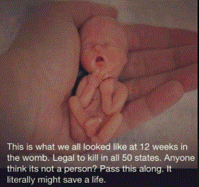 ___a person