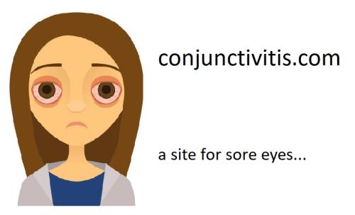 20220418 site for sore eyes