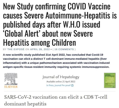 Severe Autoimmune-Hepatitis
