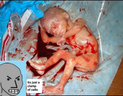 thisisnotaboutchoiceitsaboutmurder