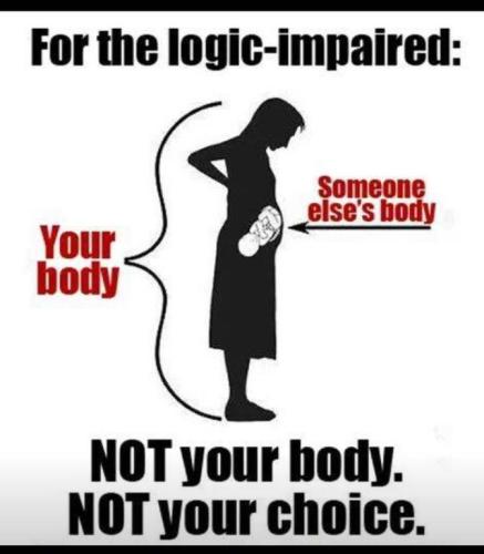 abortion not your body