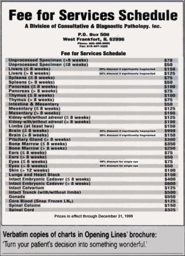 abortion baby fee-schedule