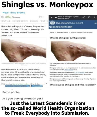 Shingles vs Monkeypox 800px