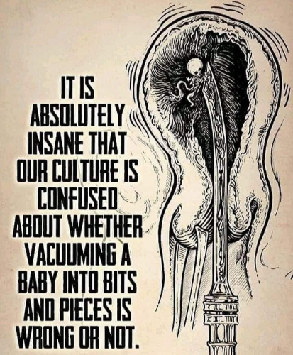 VACUMING A BABY TO BITS