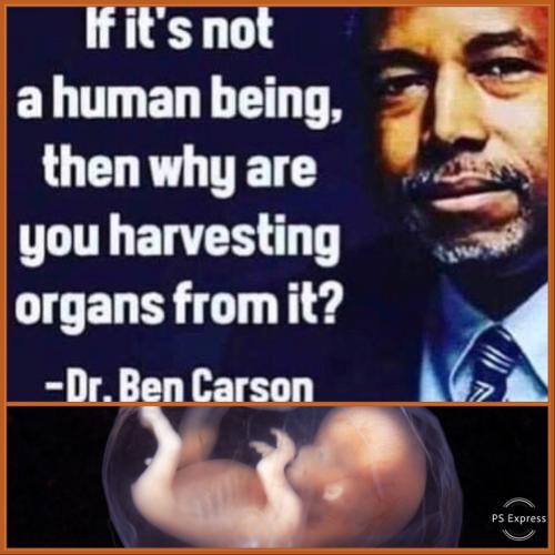 9B3378BF-328F-401D-8CC7-775B6A46DE15