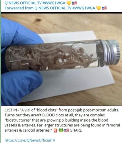 vax  clots