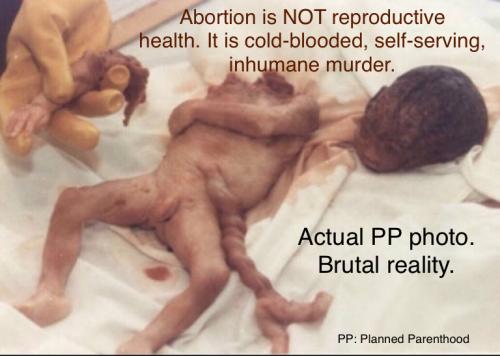 39BAE275-B375-4499-83D3-3019033326D7