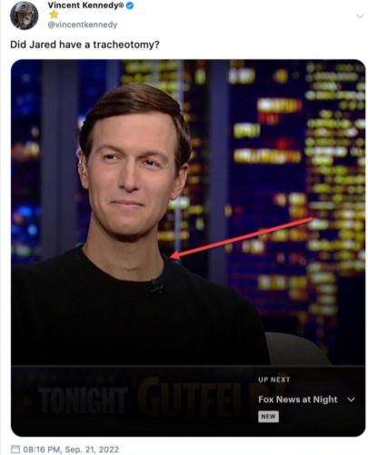 Screenshot_20220922-104958_Gallery