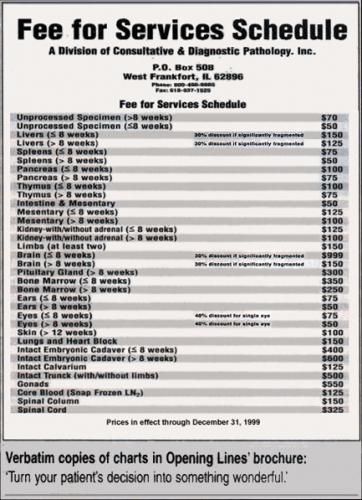 aborted baby fee-schedule