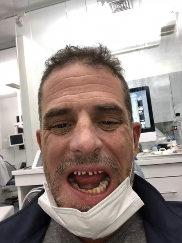 MethMouth