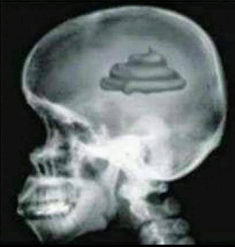 Justin Trudeau and bureaucrats' brain