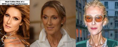 BeforeAfterAdrenochrome