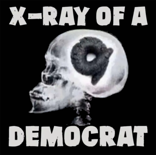 RO xray dem