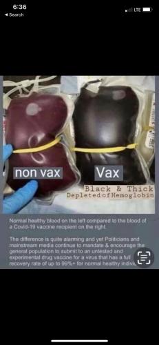NON VAX   TS