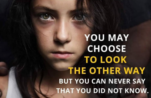 M look other way