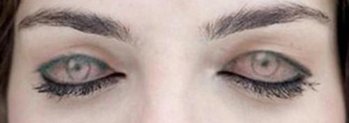 eyes