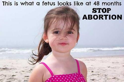 USA fetus 48 months