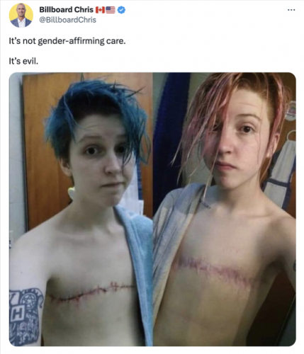 gender affirmation