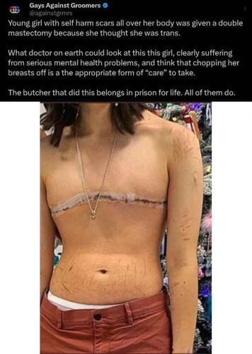 trans girl