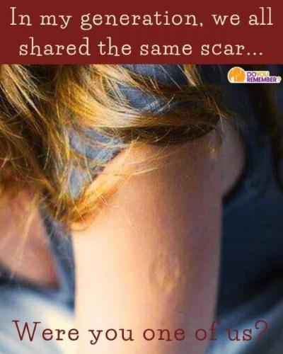 X scar