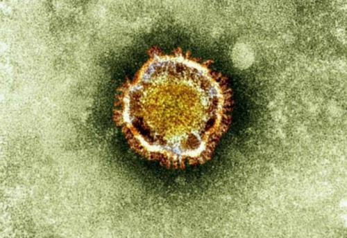 Canadian-Lab-Acquires-Coronavirus-Sample-696x480