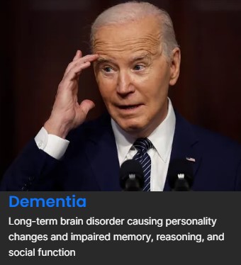 Dementia