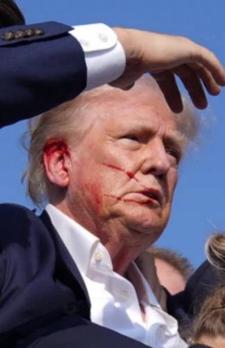 Trump Assassination Attempt (Face Shot), 7-13-2024