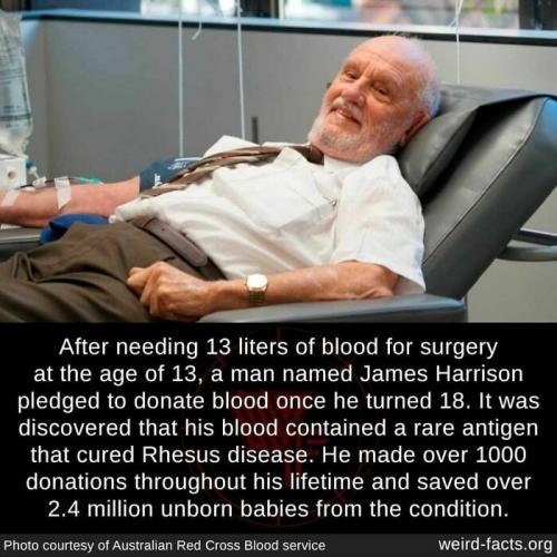 James Harrison, Rhesus Disease, Rare Antigen  -- Surgery at 13 years old using 13 liters, 1000+ Donations, Blood Cure (2.4 million saved)