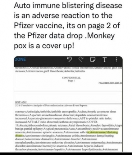 MONKEY POX IS A COVER UP   TS