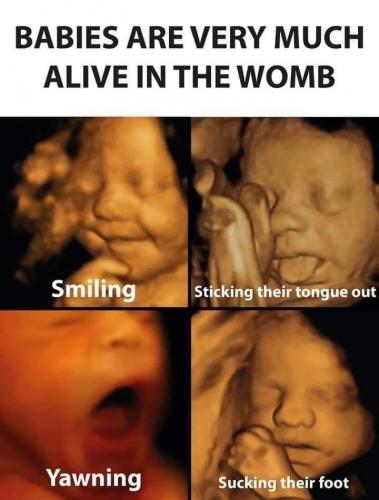 Abortion -- Baby Alive