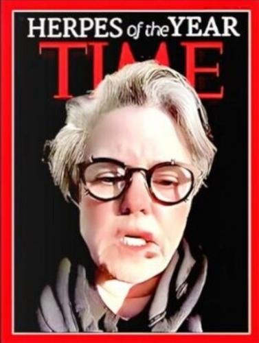 Rosie Herpes of the year