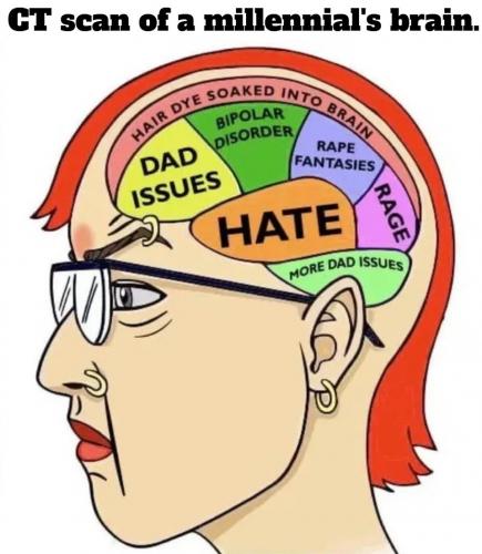 CT scan of a Millennial's brain.960px