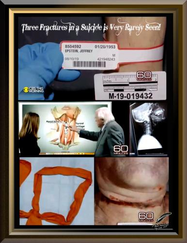 Jeffrey Epstein Apostasy  ~Forensic Pathologist Doctor Michael Baden~