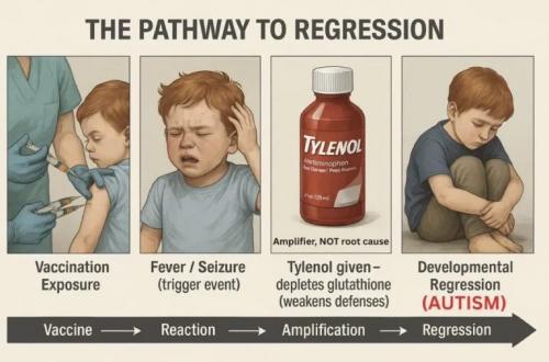 regression
