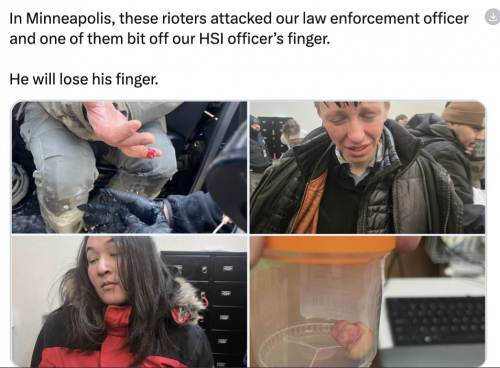 1-25-26 Ice Officer to Loose his Finger