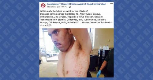 ILLEGAL DESEASES 66666666666666666666